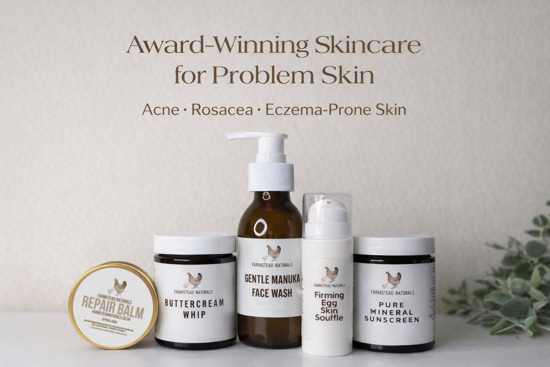 A Gentle Rosacea Skincare Routine for Calm, Supported Skin