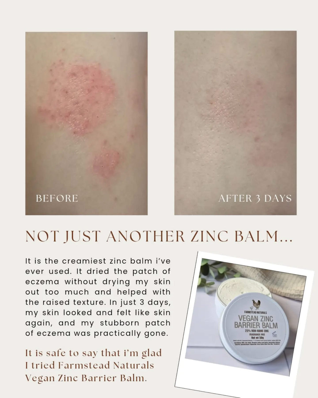 Vegan Zinc Barrier Balm (25% Non-Nano Zinc)